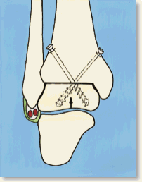 fig13