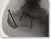 radiothumb